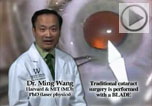 dr ming wang laser cataract