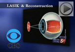 LASIK and eye reconstruction
