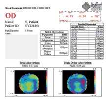 Wavefront LASIK in Nashville