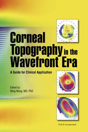 Corneal Topography in the Wavefront Era, book by Dr. MIng Wang